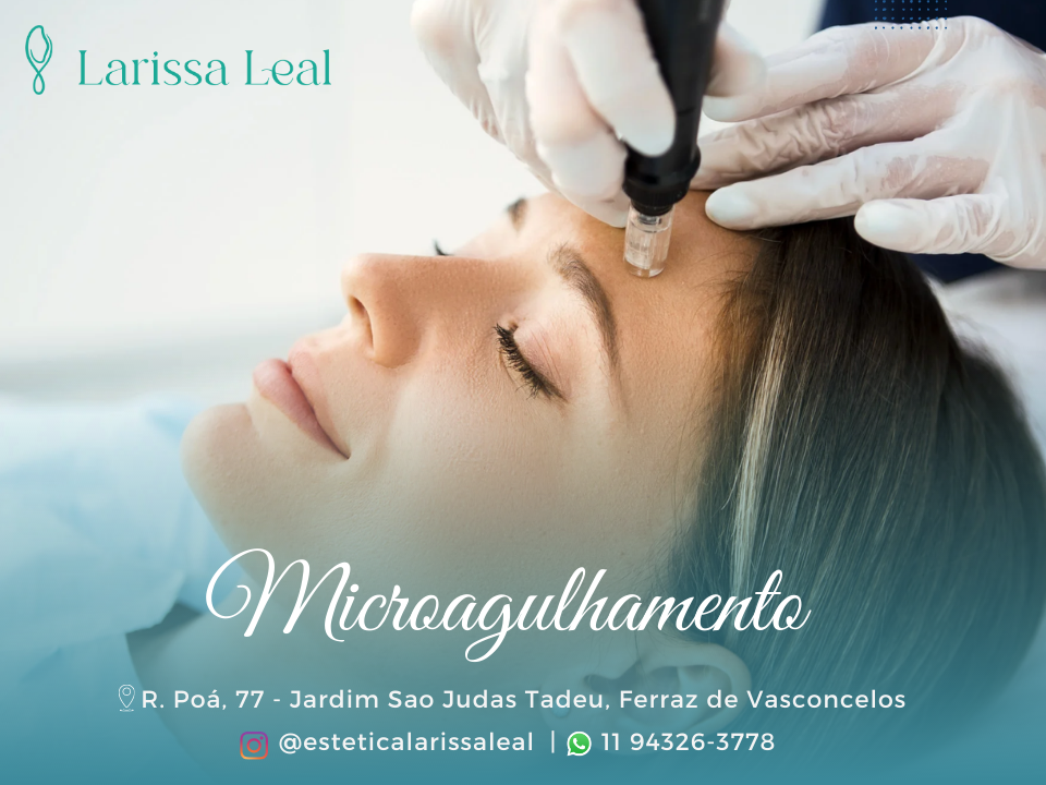 Estética Larissa Leal | Ferraz de Vasconcelos - Foto 2